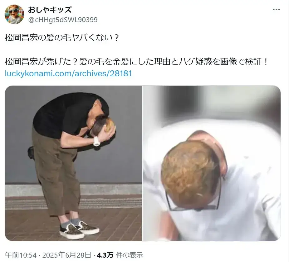 「ポスト
新しいポストを表示
会話
おしゃキッズ
松岡昌宏の髪の毛ヤバくない？」というXでの投稿