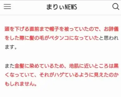 いろいろな角度から見た松岡昌宏の髪の毛と薄毛の関係の考察