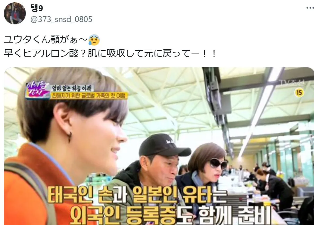 NCTユウタ（中本悠太 ）の顎の画像とファンのコメント「ユウタくん顎がぁ〜😰
早くヒアルロン酸？肌に吸収して元に戻ってー！！」
