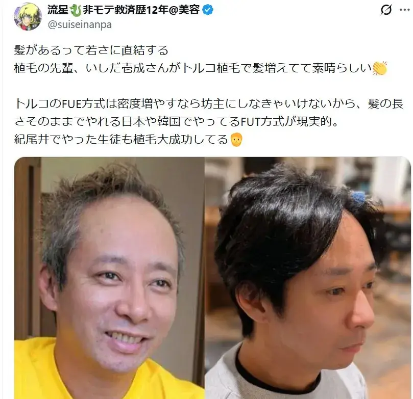 ハゲの報道や植毛報道で若返ったいしだ壱成